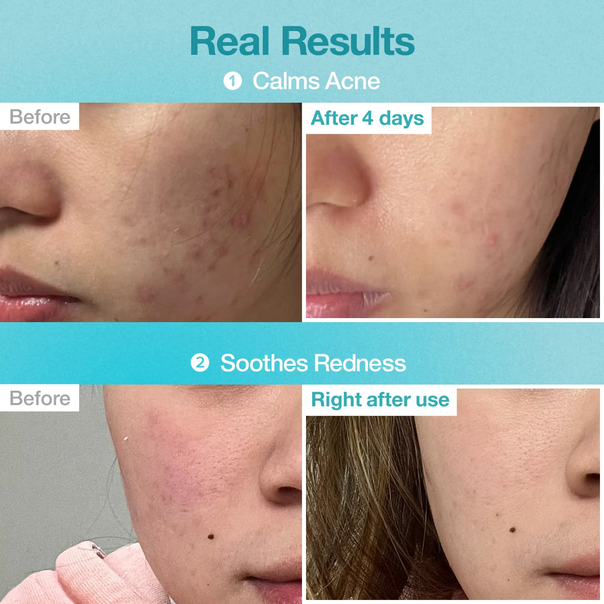 numbuzin - No.1 Pantothenic B5 Hyaluronic Active Clear Mask
