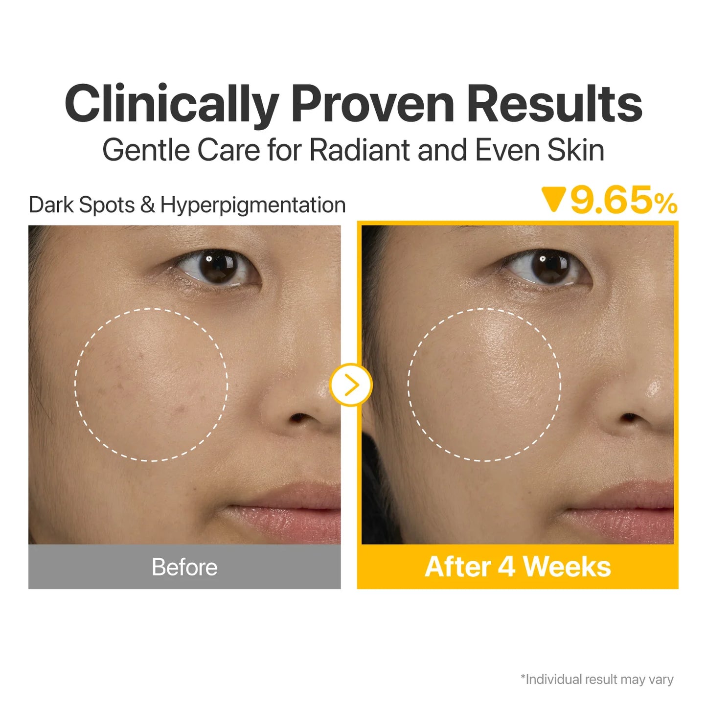 Numbuzin No.5 Vitamin Concentrated Serum (Glutathione & Vitamins)