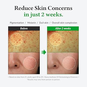 Dr. Althea - Gentle Vitamin C Serum