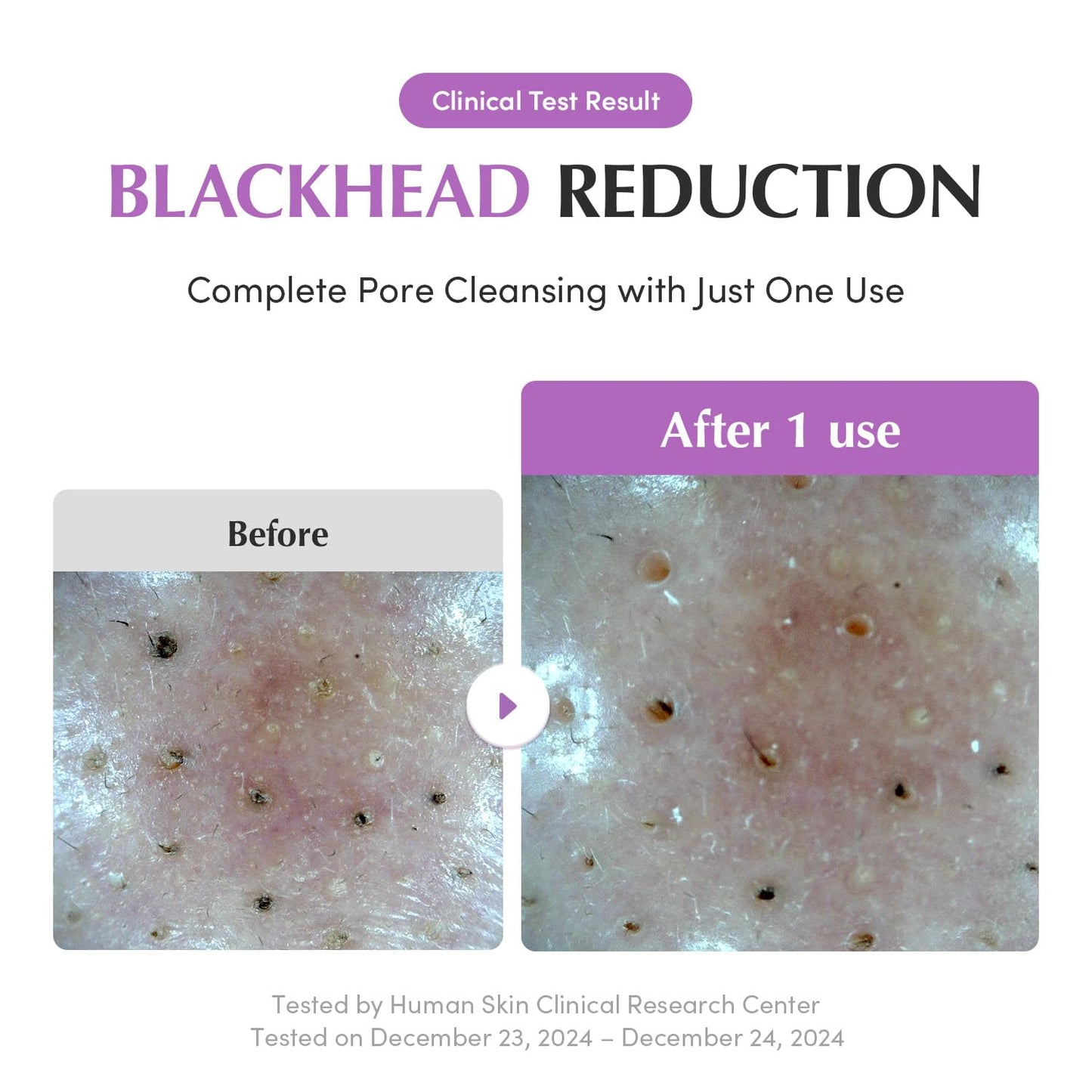 Eqqualberry Purple Rice Pore Purifying Pack Cleanser