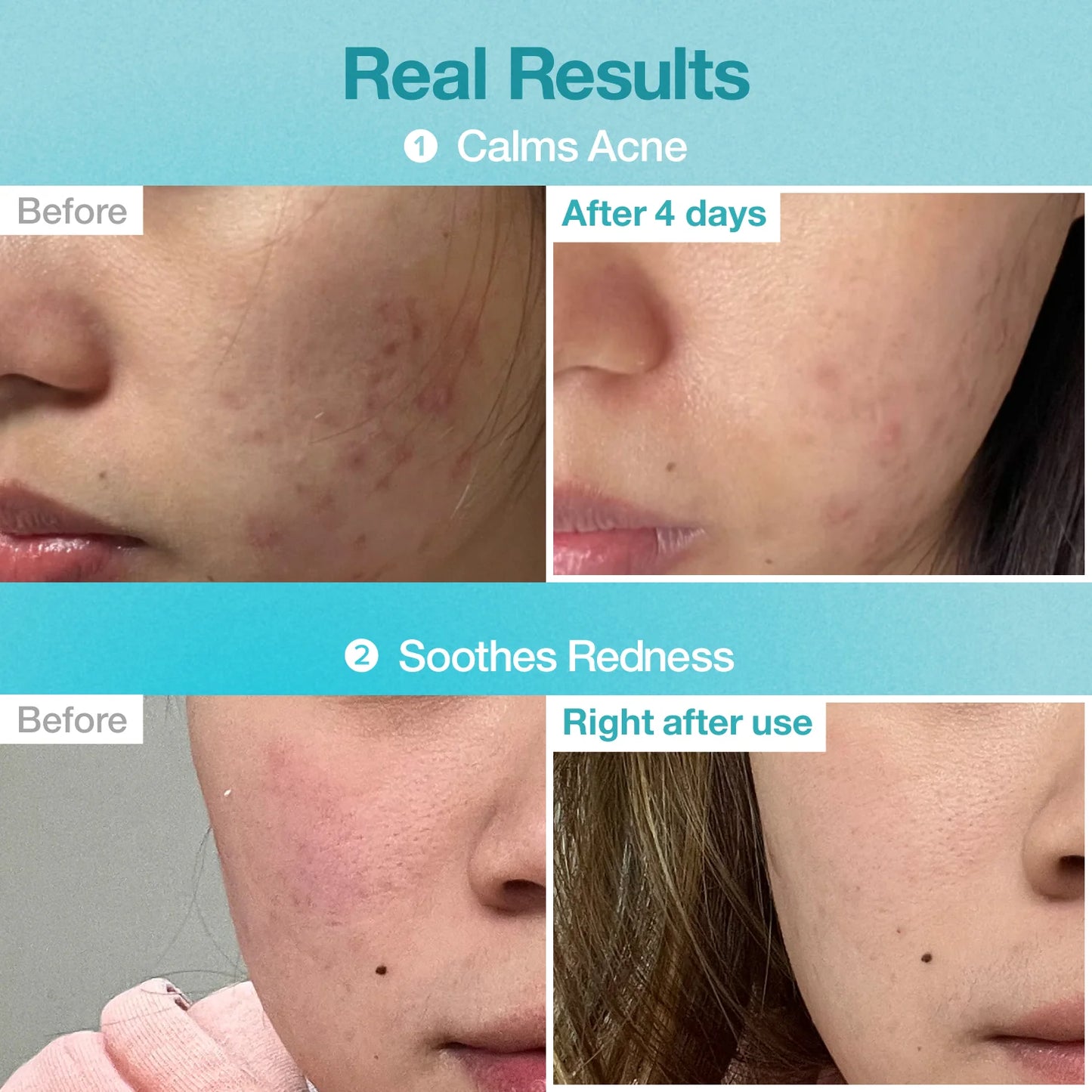 numbuzin - No.1 Pantothenic B5 Hyaluronic Active Clear Mask