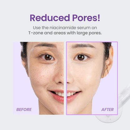 Tirtir Niacinamide 20% Serum - 30ml