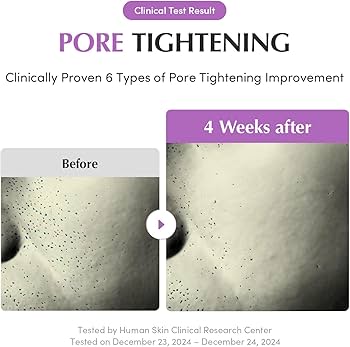 Eqqualberry Purple PDRN Pore Minimizing Serum