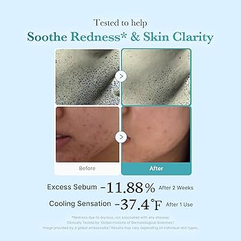 Medicube Azelaic Acid 4% Toner with Niacinamide
