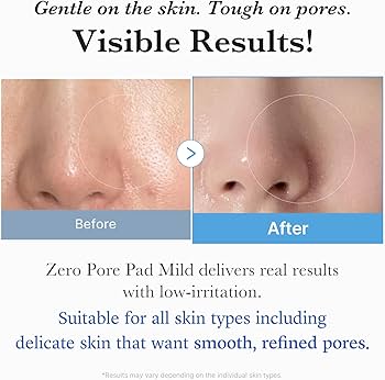 Medicube Zero Pore Pad 2.0