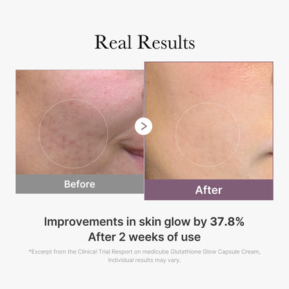 AGE-R Glutathione Glow Capsule Cream