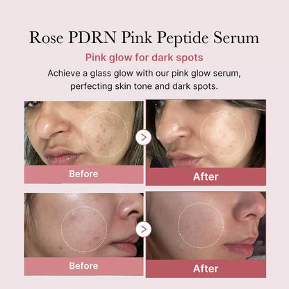 medicube pdrn pink peptide serum