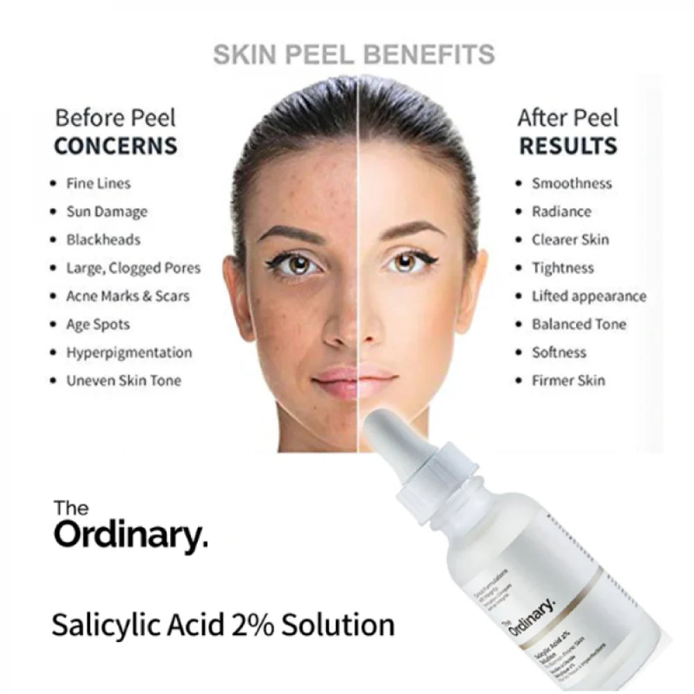 The Ordinary Niacinamide 10% + Zinc 1% - 30 ml