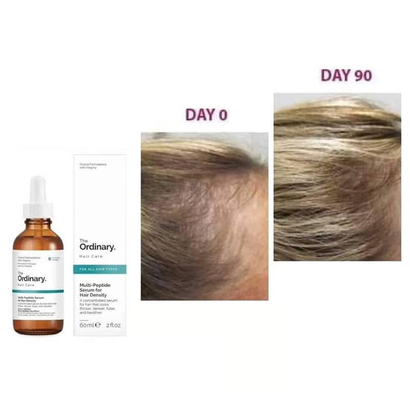 The Ordinary Multi-Peptide Serum for Hair Density
