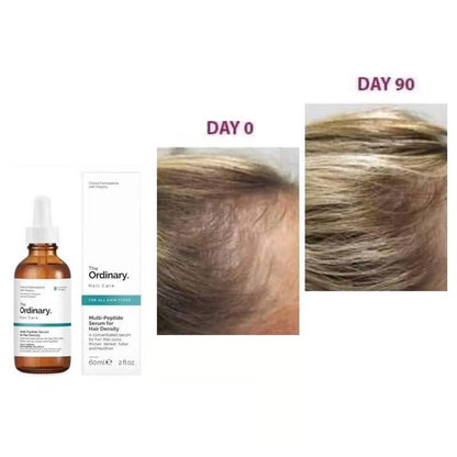 The Ordinary Multi-Peptide Serum for Hair Density