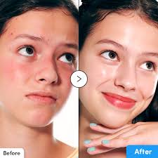 Eqqualberry Blue Blow Hyaltoin Flooding Serum