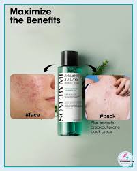 SOME BY MI AHA BHA PHA 30 Days Miracle Toner