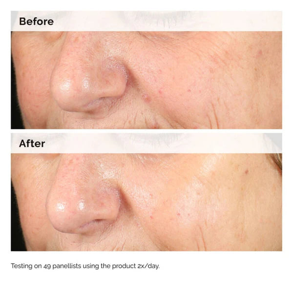 The Ordinary Alpha Arbutin 2% + HA Serum 30ml