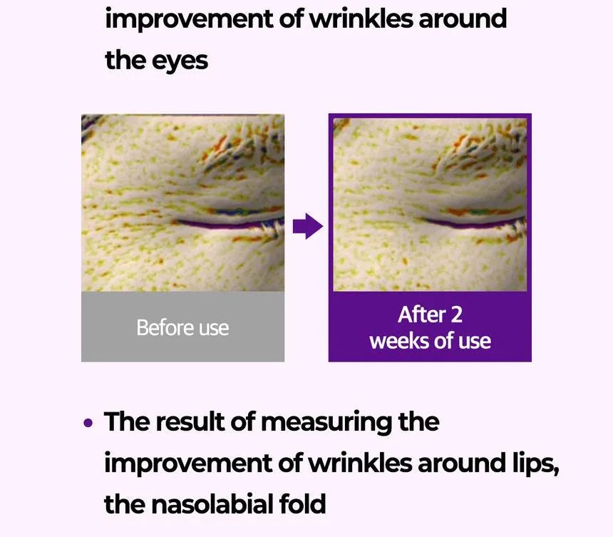 Some By Mi Retinol Intense Trial Kit